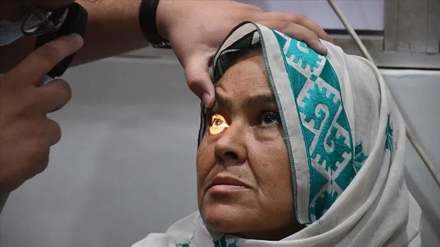 Ugandë, mbi 7.500 persona të prekur nga sëmundja ngjitëse e “syrit të kuq”